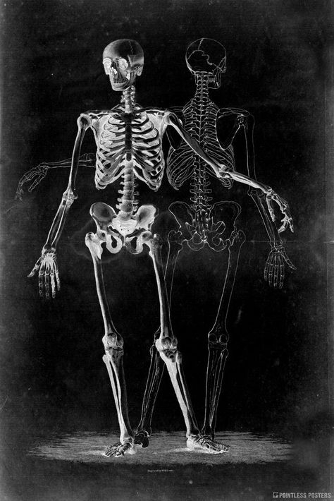 Two Skeletons On Black Gothic Poster Vintage Haircut, Two Skeletons, Gothic Landscape, Goth Room, Gothic Poster, Grunge Posters, Skeleton Drawings, Pretty Backgrounds, Skeleton Art