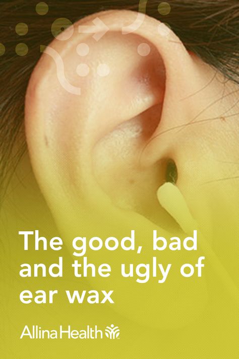 You may have heard the saying, "you should not put anything in your ears that is smaller than your elbows." But how many of us actually listen to that? If you have plugged ears or ear wax buildup, our blog article will teach you why you shouldn't reach for a Q-tip, ear wax removal candle, or other ear wax removal tools. Learn more about safe ear wax removal and plugged ear remedies. How To Get Rid Of Ear Wax Build Up, Plugged Ears Remedy, How To Remove Ear Wax Build Up, Sweet Oil For Ears, How To Unplug Ears, Plugged Ears, Ear Remedies, Clean Ear Wax Out, Candle Ear Wax Removal