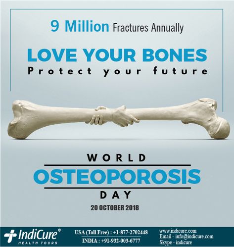 Osteoporosis is a disease that reduces bone density and often leads to fractures, pain and physical deformity. Osteoporosis can progress silently for years, showing no symptoms. This World Osteoporosis Day let’s urge our elders to take the Bone Density Test. World Osteoporosis Day Creative Ads, World Osteoporosis Day, Bone Density Test, October Awareness Month, Medical Poster, Medical Sales, Clip Art Frames Borders, Dance Logo, Therapy Exercises