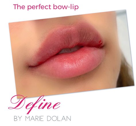 Lip fillers to plump and pout Different Types Of Lip Fillers, Lip Filler Shape Ideas Korean, Types Of Lip Filler Shapes, Pout Lip Filler, Korean Lip Filler, Lip Filler Shape Ideas, Lip Fillers Juvederm, Lips Quotes, Filler Lip