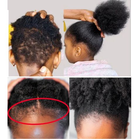 Hair Growth Grease, Hair Growth Oil Recipe, Hair Grease, Premature Grey Hair, Rosemary Hair Growth, Growth Challenge, Mary Images, Herbal Hair Growth, Eco Hair