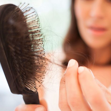 Hair loss may be irregular if you are losing even more than 100 hairs a day. This might cause a basic thinning of hair or in a patchy hair loss over the scalp. #hairlosshelp Regrow Hair Naturally, Androgenetic Alopecia, Pattern Hair, Regrow Hair, New Hair Growth, Lost Hair, Hair Reduction, Hair Regrowth, Hair Restoration