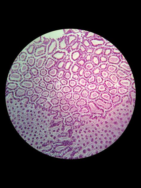 Simple epithelial cell of kidney. Tubule under microscope , #Affiliate, #cell, #epithelial, #Simple, #microscope, #Tubule #ad Animal Cell Under Microscope, Microscopic Cells Art, Cell Microscope Art, Microscopic Cells Biology Art, Human Cells Under Microscope, Cells Through Microscope, Cells Aesthetic Biology, Human Cells Microscope, Cells Under Microscope Art