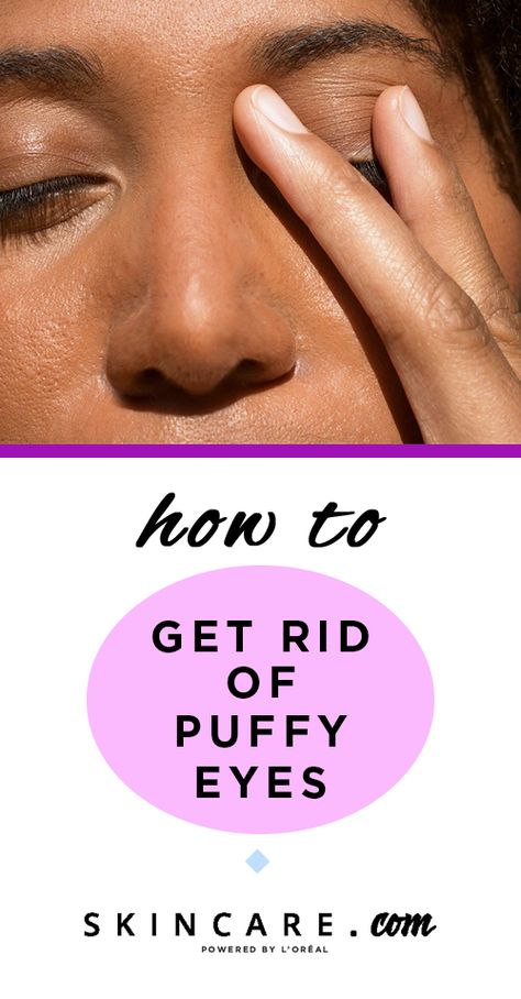 If you experience puffy-eyes, than you know how stubborn they can be to get rid of. We're helping you navigate exactly why you might be experiencing puffy eyes, and how you can reduce their appearance quickly. Plus, we're sharing some of our favorite products for the job! Puffy Eyelids How To Get Rid Of, How To Get Rid Of Puffy Eyes, Puffy Eyelids, Green Tea Mask, How To Make Greens, Women Health Care, Itchy Eyes, Alcohol Free Toner, Hooded Eyes