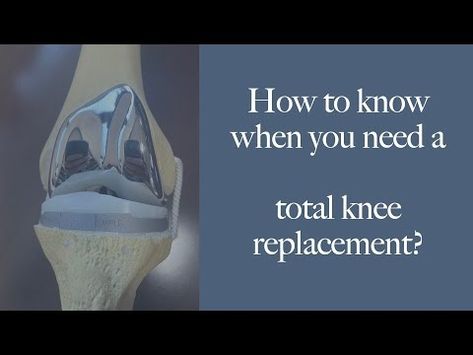 BEST REASONS to get a TOTAL KNEE replacement. How to know when & if you should have surgery - YouTube Full Knee Replacement, Knee Replacement Exercises, Knee Replacement Surgery, Knee Replacement, How To Know, Surgery, Health And Beauty, Health, Beauty