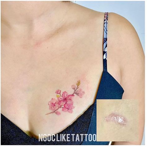 Port Tattoo Cover Up, Scar Cover Up Tattoos For Women, Tattoo Scar, Regain Confidence, Cover Up Tattoos For Women, Tattoo Over Scar, Survivor Tattoo, Scar Cover Up, Tattoos To Cover Scars