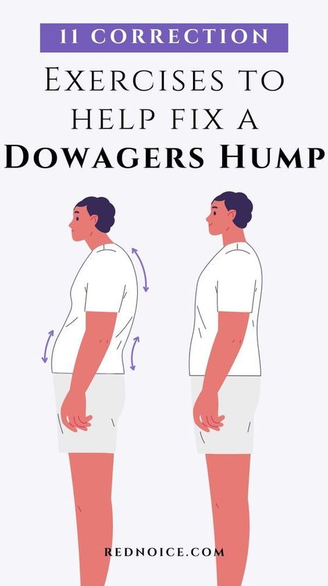 Improve your posture and minimize that dowager's hump with 11 stretches and exercises focused on correction and prevention. By strengthening your upper back while gently mobilizing tight areas around your neck and shoulders, these daily routines can help you achieve better alignment and reduce rounding in your upper back. Make these moves part of your regimen to get rid of that hump for good! Improve Posture Exercises, Dowagers Hump, Neck Posture, Dowager's Hump, Posture Stretches, Better Posture Exercises, Posture Correction Exercises, Forward Head Posture Exercises, Neck And Shoulder Exercises