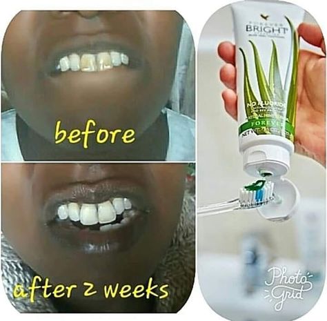 Health Consultant, Aloe Vera Gel Forever, Forever Bright Toothgel, Aloe Vera Gel Drink, How To Be Healthy, Forever Living Aloe Vera, Tooth Gel, Best Toothpaste, Get Whiter Teeth