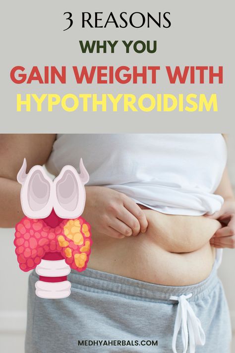 Can Hypothyroidism cause weight gain? The relation between Hypothyroidism weight gain and your Metabolism. Learn here Ayurvedic natural tips to lose weight with hypothyroidism. Start today! Herbs To Burn, Thyroid Surgery, Ayurvedic Tips, Thyroid Symptoms, Hashimotos Disease, Thyroid Medication, Thyroid Health, Help Losing Weight, Fat Removal