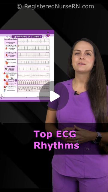 Ecg Rhythms Cheat Sheets, Ekg Interpretation, Ecg Interpretation, Critical Care Nursing, About Heart, Heart Rhythms, Nursing Notes, Critical Care, Nclex