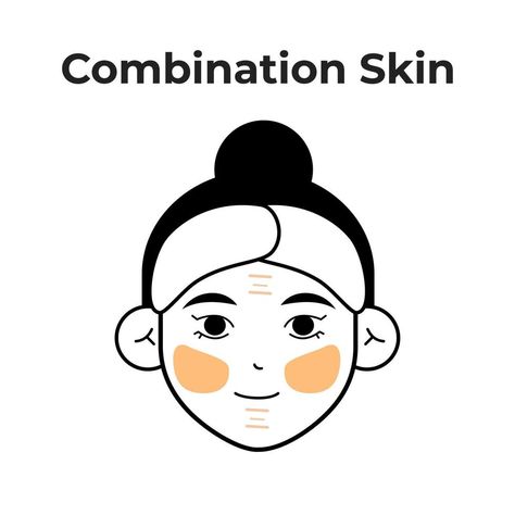 combination skin Type Skin Tone Names, Skin Animation, Type Of Skin, Combination Skin Type, Different Skin Tones, Acne Remedies, Homemade Remedies, Skin Concern, Combination Skin