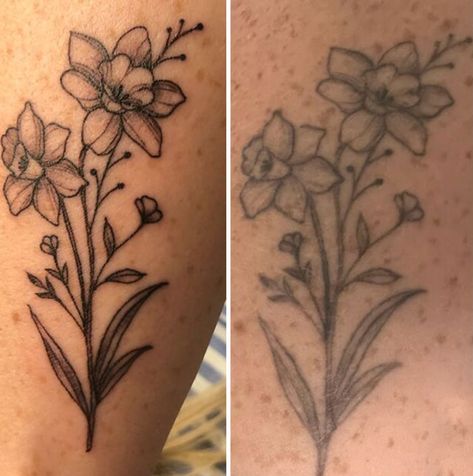 Fine Line Tattoo- 1 Year Old Single Needle Tattoo, Laser Removal, Tattoo People, Fine Line Tattoo, Healing Tattoo, Anchor Tattoo, Old Tattoos, Laser Tattoo, Laser Tattoo Removal