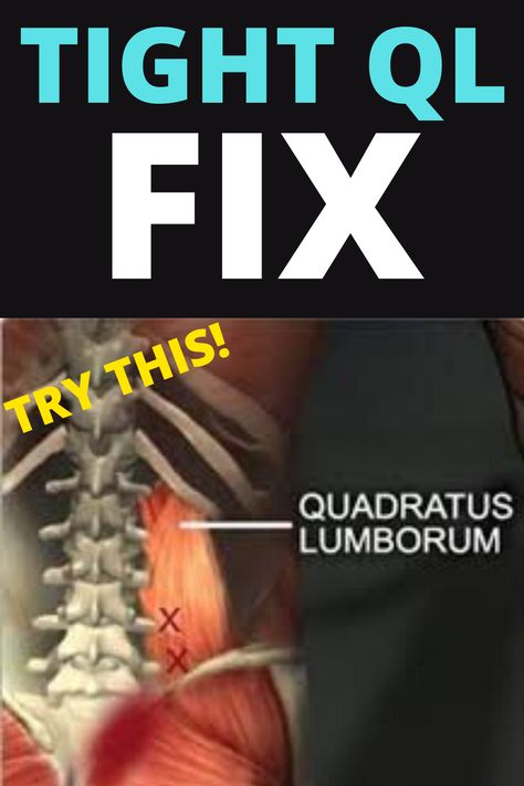 Quadratus Lumborum Stretch, Ql Stretch, Quadratus Lumborum, Swimming Benefits, Healthy Spine, Chronic Back Pain, Tight Hamstrings, Back Stretches For Pain, Lower Back Pain Exercises