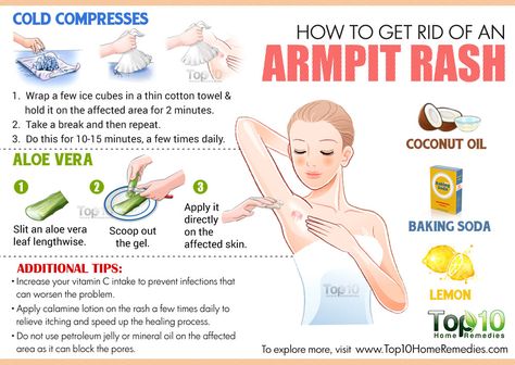 Go to the full website for lots of tips, not just this graphic. Armpit Rash, Skin Care Routine 40s, Forehead Acne, Natural Acne Remedies, Natural Acne, Hormonal Acne, Cystic Acne, Acne Remedies, Skin Remedies