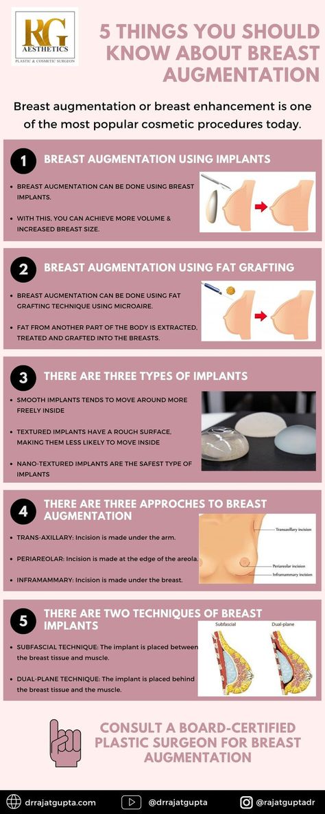 Fat Grafting Breast, Mommy Makeover Surgery, Saline Implants, Increase Breast Size, Silicone Implants, Fat Grafting, Fat Transfer, Mommy Makeover, Botox Fillers