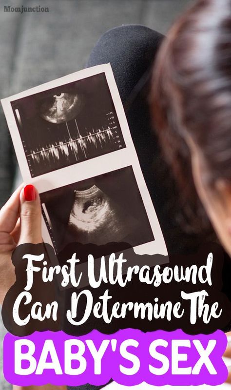 Baby Heart Rate Gender, Ultrasound Boy Or Girl, 8 Weeks Pregnant Ultrasound, Boy Ultrasound Pictures, Baby Gender Ultrasound, 8 Week Ultrasound, Ultrasound Gender Prediction, Boy Or Girl Prediction, Boy Ultrasound