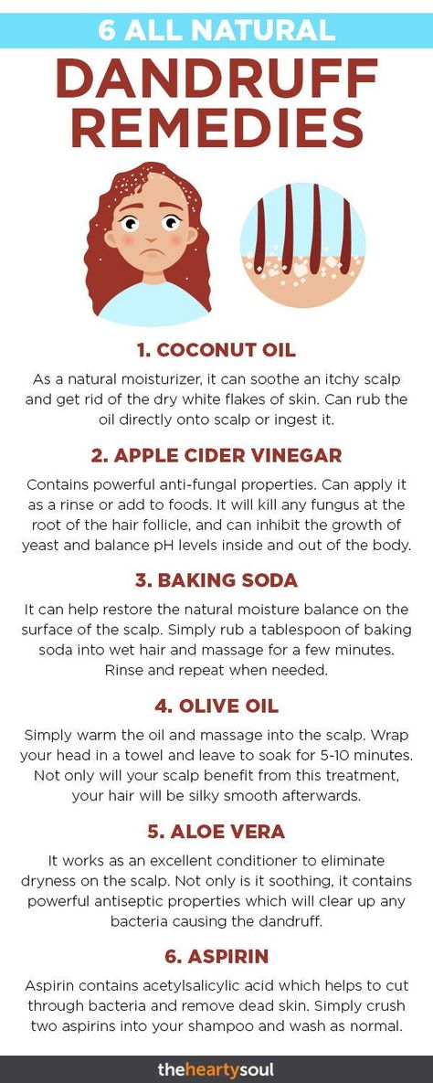 beauty glazed gorgeous me Natural Dandruff Remedy, Dry Scalp Treatment, Dandruff Remedy, Scalp Treatments, Dandruff Treatment, Natural Healing Remedies, Stop Trying, Itchy Scalp, Natural Therapy