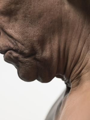 Who else wants a beautiful neck?  When you check this out you will be on your way to one.  Guaranteed.  http://lawebmarketers.net/wrinklefree http://lawebmarketers.net/wrinklefree Sagging Neck Skin, Neck Tightening, Sagging Neck, Turkey Neck, Neck Exercises, Neck Wrinkles, Muscles In Your Body, Saggy Skin, Face Wrinkles