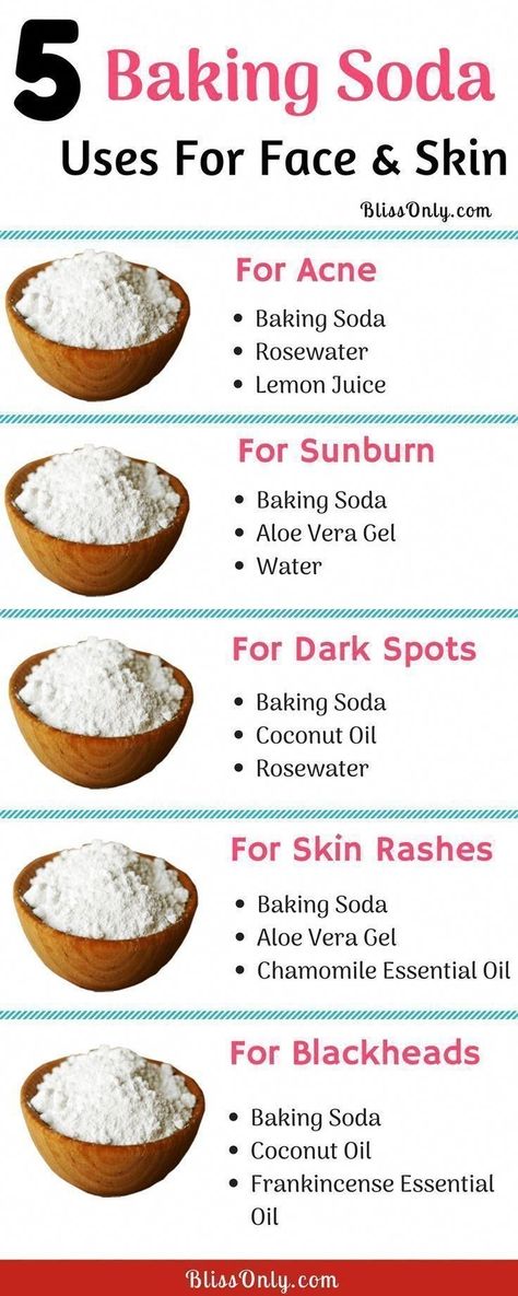 Blackhead Remover Diy, Skin Rashes, Acne Dark Spots, Baking Soda Uses, Baking Soda Shampoo, For Skin Care, Skin Care Remedies, Skin Care Recipes, Diy Skin Care