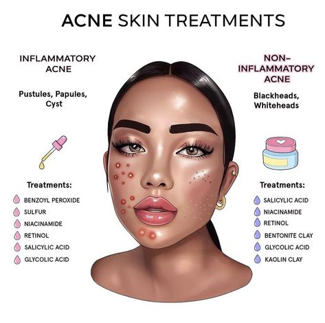 Best Skincare Products for Hyperpigmentation and Dark Spots Skin Treatments For Dark Spots Beauty Products, Skincare Products For Hyperpigmentation, Glowing Body Skin, Products For Hyperpigmentation, Mild Acne, Dry Skincare, Instagram Skincare, Face Tips, Acne Treatments