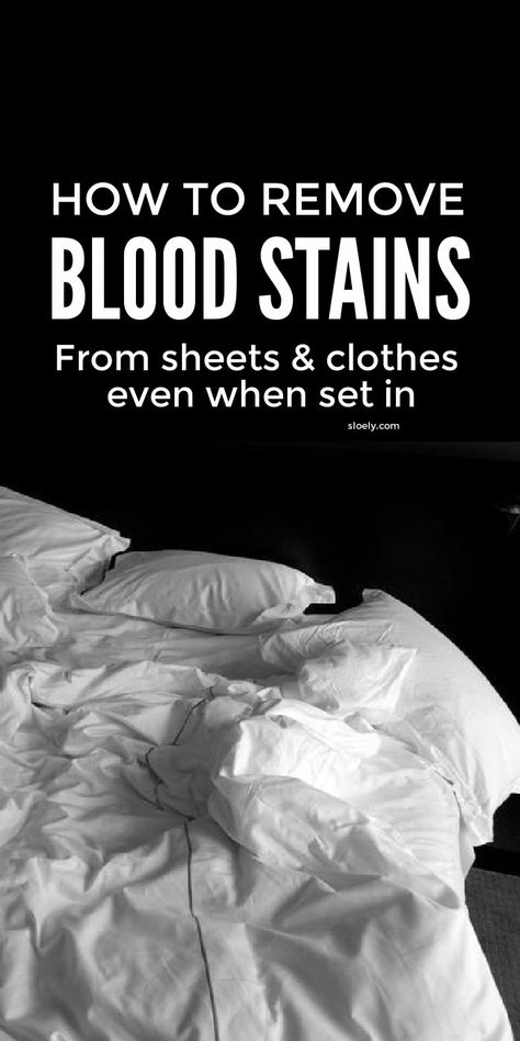 Blood Out Of Clothes, Get Blood Stains Out, Remove Blood Stains, Blood Stain Removal, Natural Stain Remover, Baking Soda Benefits, Deep Cleaning Hacks, Stain On Clothes, Old Blood