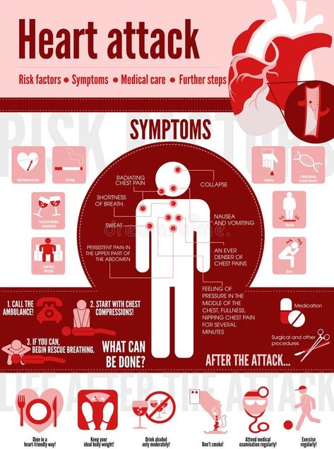 Illustration about Vector medical poster heart attack. Symptoms of the disease. Prevention. Illustration of cute sick girl. Illustration of cardiology, disease, cute - 159007627 Heart Infographic, Disease Infographic, Foot Reflexology Massage, World Heart Day, Medical Posters, Health Guru, Health Signs, Infographic Poster, Sciatic Nerve Pain