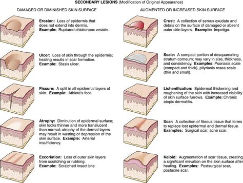 Skin Esthetics, Dental Notes, Project Notebook, Skin Lesions, Skin Anatomy, Esthetician School, Blackhead Remedies, Skin Facts, Skin Layers