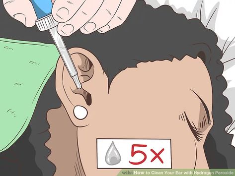 Cleaning Ears With Peroxide, Natural Ear Wax Removal, Hydrogen Peroxide Ear, Clean Ear Wax Out, Saline Rinse, Ear Cleaning Wax, Ear Wax Buildup, Peroxide Uses, Ear Pressure