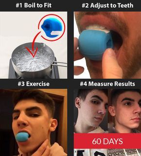 How to Get a Perfect Jawline | Best Way to Get Rid of Double Chin - JawlineMe Perfect Jawline, Jawline Exercise, Facial Exercise, Face Fitness, Chiseled Jawline, Face Fillers, Fitness Ball, Trening Sztuk Walki, Facial Surgery