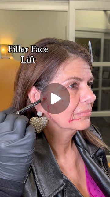 LIFTED BEAUTY on Instagram: "Filler Face Lift 🤩  To book an appointment text or call our office at (562) 331-6543   Click the link in our bio to see our online schedule to book an appointment with one of Our Medical Providers 📲 . Want More Info Before Coming in? Book A Free Consultation Call with Our Patient Care Coordinator ✨ . $45.00 Booking Fee Required To Book An Appointment 💰 . ⚠️Cancellation Policy ⚠️ $100 will be charged if appointment is not canceled within 48hrs of Scheduled Appointment Time . All products are FDA approved. Please visit the manufacturers website of the products that we use for all risk and side effects 🙌🏼 . All our treatments are customized to fit our patients anatomy and needs. Keep in mind that the number of units, syringes, threads or sessions needed will Threading Face Lift, Filler Face Lift, Face Fillers Before And After Jaw, Mid Face Filler, Facial Contouring Fillers, Facial Fillers Before And After, Smile Line Fillers Before And After, Face Balancing Fillers, Face Fillers Before And After