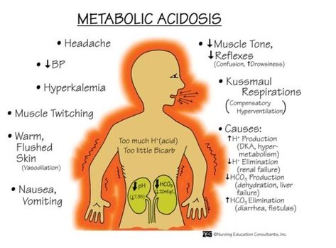 Road to RN — Metabolic Acidosis & Metabolic Alkalosis S&S Metabolic Acidosis, Acid Base Balance, Nurse Manager, Nursing Mnemonics, Nursing School Survival, Nurse Rock, Nursing School Studying, Nursing School Tips, Nursing School Notes