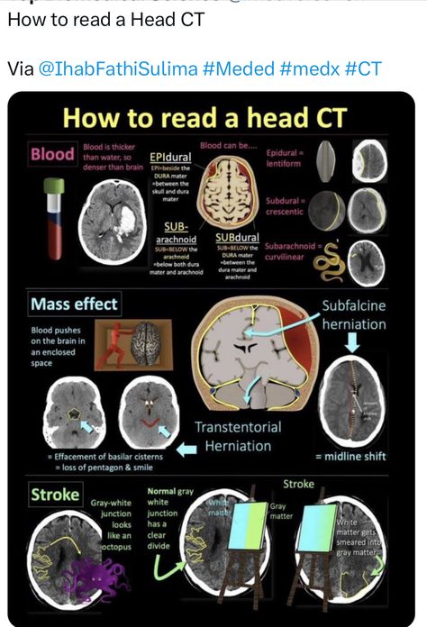 Medical Radiography, Radiology Student, Nursing Information, Nursing School Essential, Medical School Life, Basic Anatomy And Physiology, Nurse Study Notes, Medical Student Study, Medical Laboratory Science