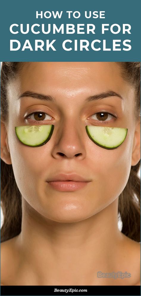 How to Remove Dark Circles with Cucumber? Cover Up Dark Circles Under Eyes, Dark Undereyes, Dark Circle Remedies, Cucumber On Eyes, Brown Spots On Skin, Lotion For Oily Skin, Dark Eye Circles, Face Tips, Brown Spots Removal