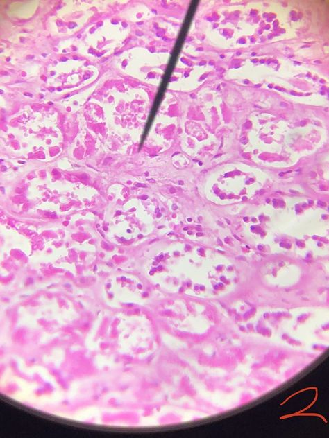 Found in the lungs, it's function is for rapid diffusion Simple Squamous Epithelium, Squamous Epithelium, Lungs, Quick Saves