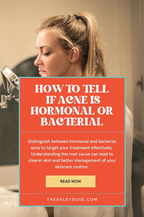 Discover the secrets to identifying hormonal versus bacterial acne with our expert insights! From the location of pimples to timing of breakouts, learn the key differences that can help you pinpoint the root cause of your skin woes. Take charge of your skincare routine and say goodbye to acne frustrations. #SkinCareExperts #ClearSkin #AcneAwareness How To Prevent Hormonal Acne, Best Products For Hormonal Acne, Hormone Acne, Hormonal Acne Skincare Routine, Hormonal Acne Skincare, Bacterial Acne, Hormonal Acne Diet, Hormonal Acne Supplements, Hormonal Acne Remedies