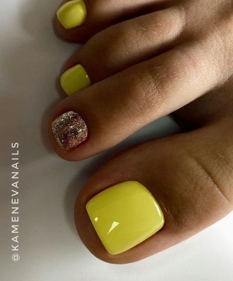 Toenails For Summer, Pedicure Ideas Summer Yellow, Pedicure Ideas Yellow, Summer Gel Toes, Gel Toe Nails Summer Toenails, Yellow Pedicure Toenails, Yellow Pedicure Ideas, Summer Pedicure Designs Toenails, Yellow Toe Nail Designs