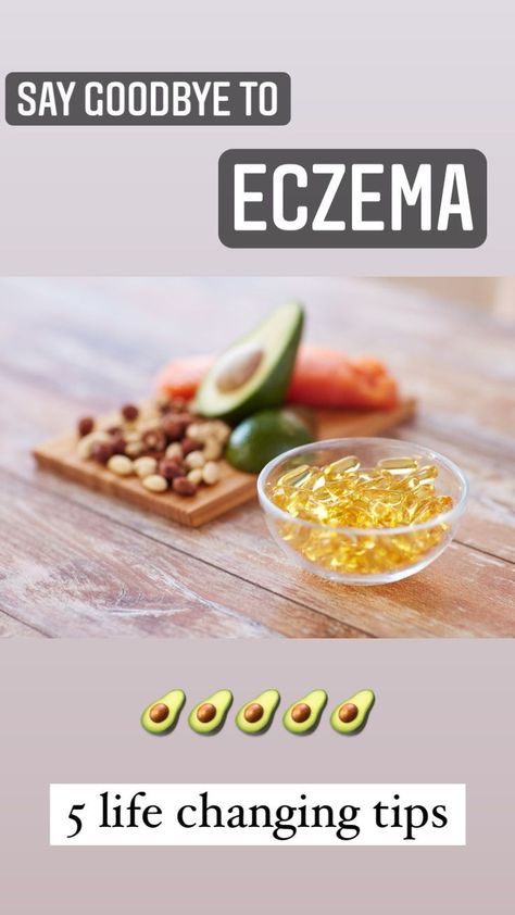 Natural Remedies Ezcema Diet, Life Changing Tips, Natural Skin Care Ingredients, Dry Skin Remedies, Skin Remedies, Healing Food, Healthy Eating Habits, Health Remedies, Life Changing