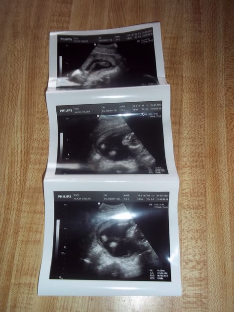 first pictures of our baby Pregnant Prank, Black Love Movies, Fake Pregnancy, Ultrasound Technician, Ultrasound Tech, Ectopic Pregnancy, Baby Pictures Newborn, Baby Hospital, Story Ideas Pictures