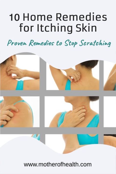 10 Home Remedies for Itching Skin | Mother Of Health Skin Itching, Itching Skin, Skin Care Routine 30s, Itch Relief, Holistic Remedies, Health Guide, Skin Remedies, Best Moisturizer, Natural Beauty Tips