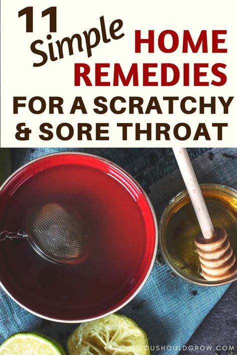 Text overlay: 11 simple home remedies for a scratchy and sore throat Home Remedies For Sinus, Scratchy Throat, Throat Remedies, Sore Throat Remedies, Homestead Life, Backyard Farm, Sick Remedies, Natural Headache Remedies, Holistic Health Remedies