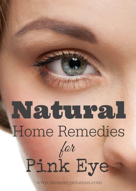 5 Natural Remedies For Pink Eye Remedies For Pink Eye, Crusty Eyes, Natural Pink Eye Remedy, Eye Stye Remedies, Pinkeye Remedies, Toenail Fungus Remedies, Pink Eye, Holistic Remedies, Natural Health Remedies