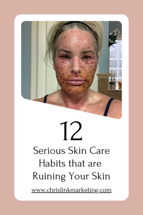 Learn the secrets to flawless skin with my comprehensive guide to serious skin care habits. Learn how to avoid common pitfalls like over-exfoliation and neglecting sunscreen while discovering effective solutions for acne, wrinkles, and anti-aging. Dive into the world of skincare routines and products tailored to transform your complexion. Say goodbye to bad habits and hello to radiant, healthy skin. Bad Skincare, Skincare Mistakes, Skincare Habits, Clean Blackheads, Serious Skin Care, Perfect Skin Care Routine, Beauty Advice, Skin Products, Skin Routine