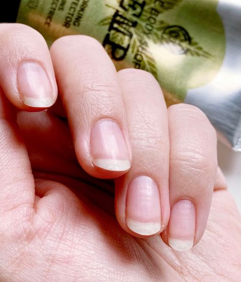 Do soak-off UV gel manicures ruin your nails? I had back-to-back soak-off UV gel manicures for 10 years. The pandemic put a stop to that. Here's what my naked nails are like eight months later. No Polish Manicure, Nail Damage From Gel, How To Soak Off Gel X Nails, Gel X Nails Removal, Manicure After Acrylic Removal, Manicure On Bitten Nails, Nail Protector, Naked Nails, Short Round Nails