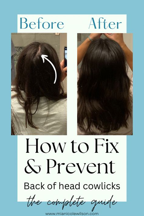 How to easily get rid of cowlicks in hair Cowlick Hairstyles, Futuristic Hair, Hair Parts, Egyptian Hairstyles, Ugly Hair, Parting Hair, Gothic Hairstyles, Hair Fixing, Hair Nets