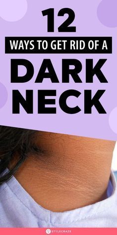 How To Get Rid Of Dark Neck: 13 Effective Home Remedies To Try Dark Skin Remedies, Pack For Dark Neck, How To Make Your Neck Lighter, Neck Hyperpigmentation, Dark Skin Around Neck, Dark Neck Remedies, Get Rid Of Dark Neck, Dark Neck, Detox Body