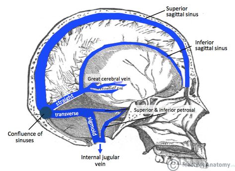 Cerebral venous sinus thrombosis (CVST) is the presence of acute thrombosis (a blood clot) in the dural venous sinuses, which drain blood from the brain. Dural Venous Sinuses, Mri Brain, Gross Anatomy, Brain Surgeon, Craniosacral Therapy, Basic Anatomy And Physiology, Brain Anatomy, Medical School Studying, Medical Anatomy