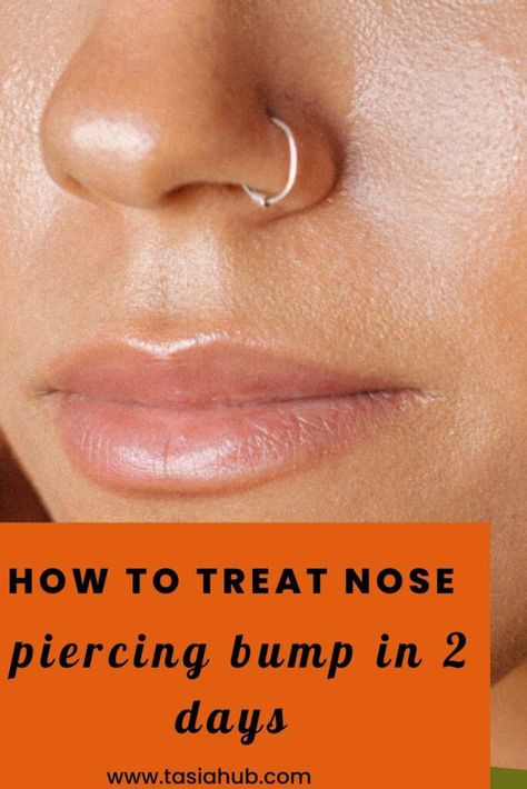 Nose Ring Bump, Nose Piercing Infection, Nose Piercing Care, Nose Piercing Healing, Blood Blister, Nose Peircing, Nose Piercing Bump, Piercing Bump, Unique Nose Rings