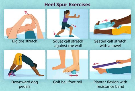 Heel Spur Exercises Exercises For Heel Spur, Heel Spur Relief Exercise, Bone Spur Heel, Heel Pain Exercises, Heal Spurs, Heel Spur Relief, Calcaneal Spur, Foot Pain Relief Remedies, Equestrian Training