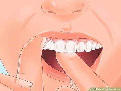 How to get pinker gums! Dental Hygiene Routine, Home Gum, Dark Gums, Teeth Whitening Homemade, Swollen Gum, Healthy Gums, Neck Exercises, Receding Gums, Hygiene Routine