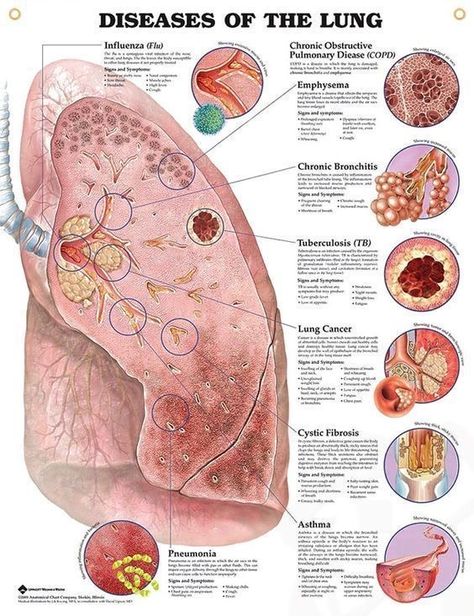 Lung Anatomy, Anatomy Poster, Body Diagram, Pulmonology, Medical Student Study, Respiratory Care, Nursing School Survival, Respiratory Therapy, Nursing School Studying